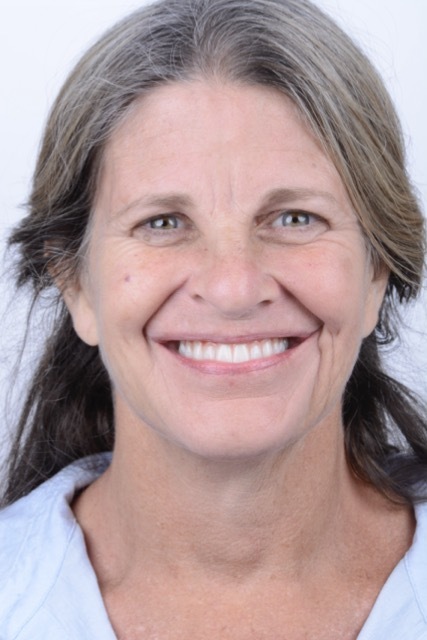 Female patient smiling after dental implant treatment